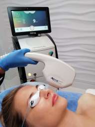 laserowe zamykanie naczynek dye- vl.jpg